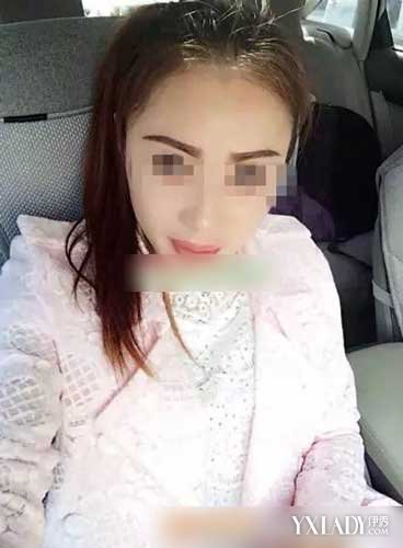 女子称做完私密手术后头晕嘴歪