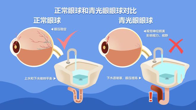 世界青光眼日