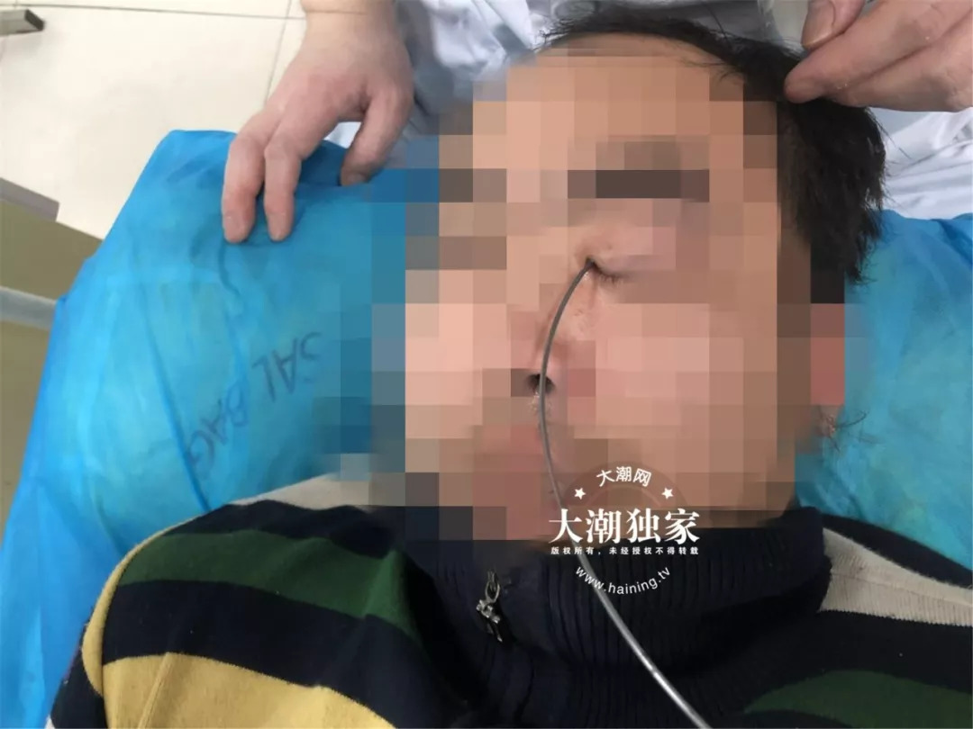 男子拆快递遭横祸几十根细刺扎眼球