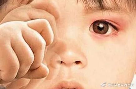 医生回应男童吃叶黄素软糖患干眼症