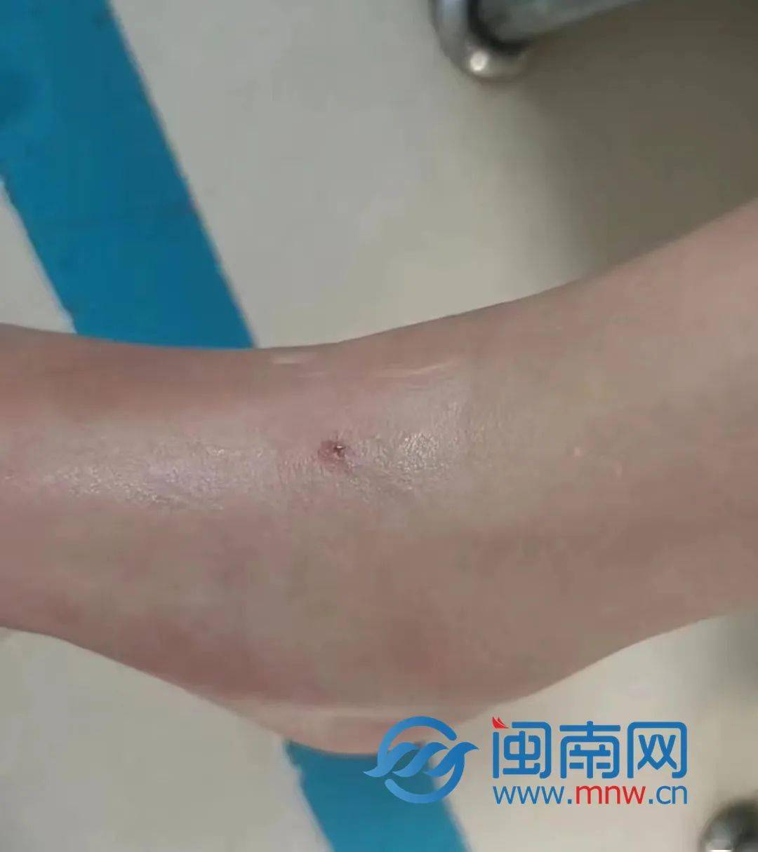 三亚女游客被蛇咬伤身亡 家属发声